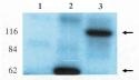 Western blot analysis
using anti-Lfc antibody
on HEK-293 cell
transfected with vector
alone (1), lfc-short (2)
and lfc-long (3).